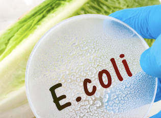 Phương Pháp Kiểm Nghiệm Vi Sinh Trong Thực Phẩm: Escherichia coli O157:H7