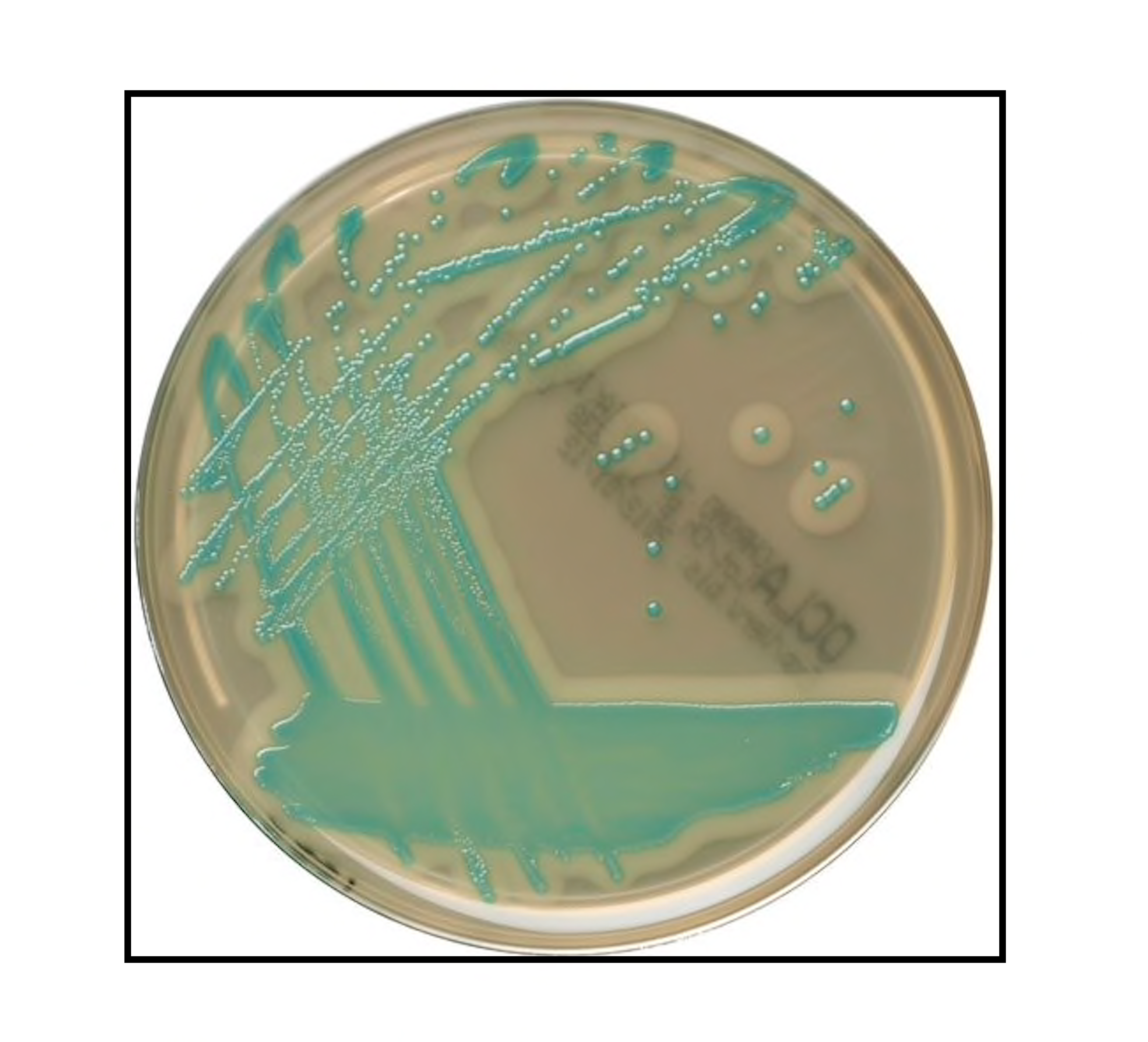 Phương pháp kiểm tra nhanh LISTERIA PRECIS