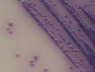 So Sánh Các Phương Pháp Phát Hiện Nhanh Salmonella trên môi trường nuôi cấy.