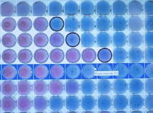 Thermo Scientific ™ Sensititre ™ Vizion ™