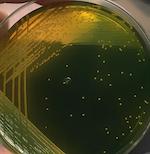 PHÁT HIỆN NHANH VIBRIO TRONG THUỶ SẢN BẰNG BỘ KIT PCR ĐA MỤC TIÊU SURETECT